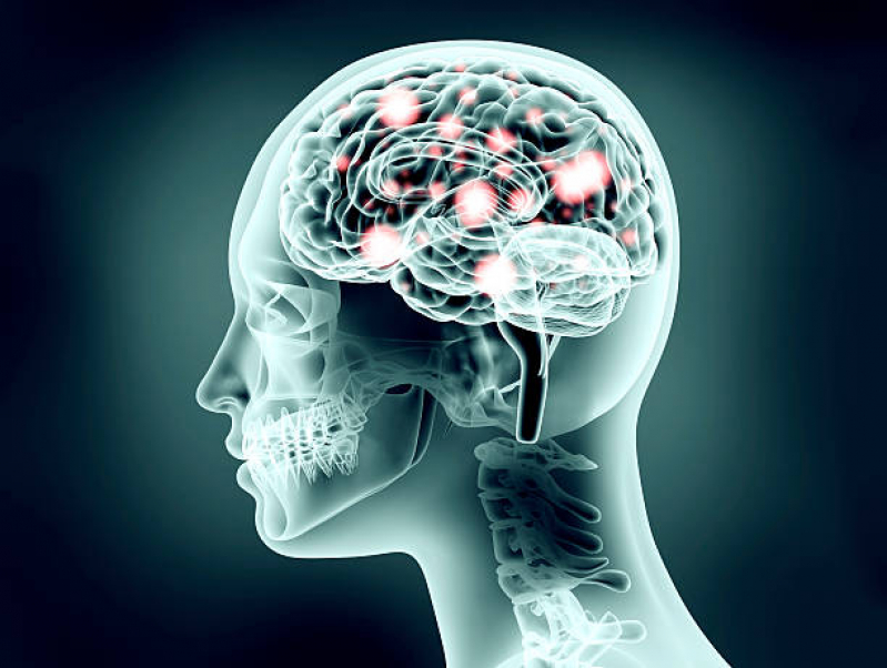 Clínica de Neuromodulação Cerebral Centro Histórico - Neuromodulação Cerebral