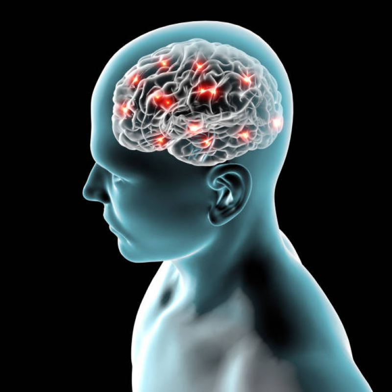 Clínica de Neuromodulação para Dor Camaquã - Neuromodulação Cerebral