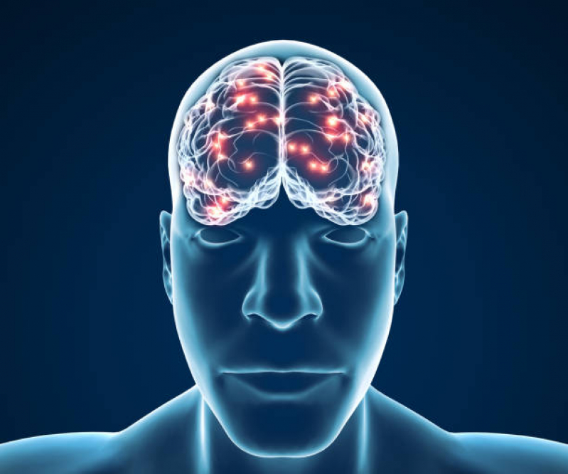 Clínica de Neuromodulação Pós Avc Teresópolis - Neuromodulação Cerebral