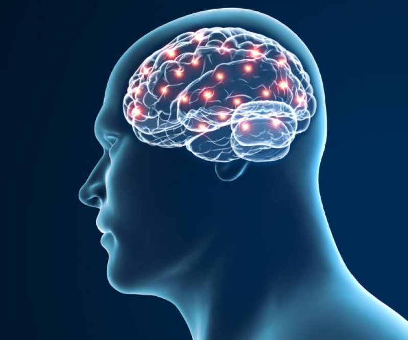 Neuromodulação Avc Agendar Lomba do Pinheiro - Neuromodulação Cerebral