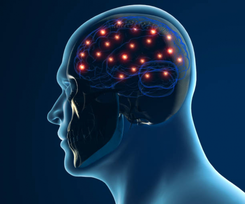 Neuromodulação para Ataxia Marcar Camaquã - Neuromodulação Cerebral