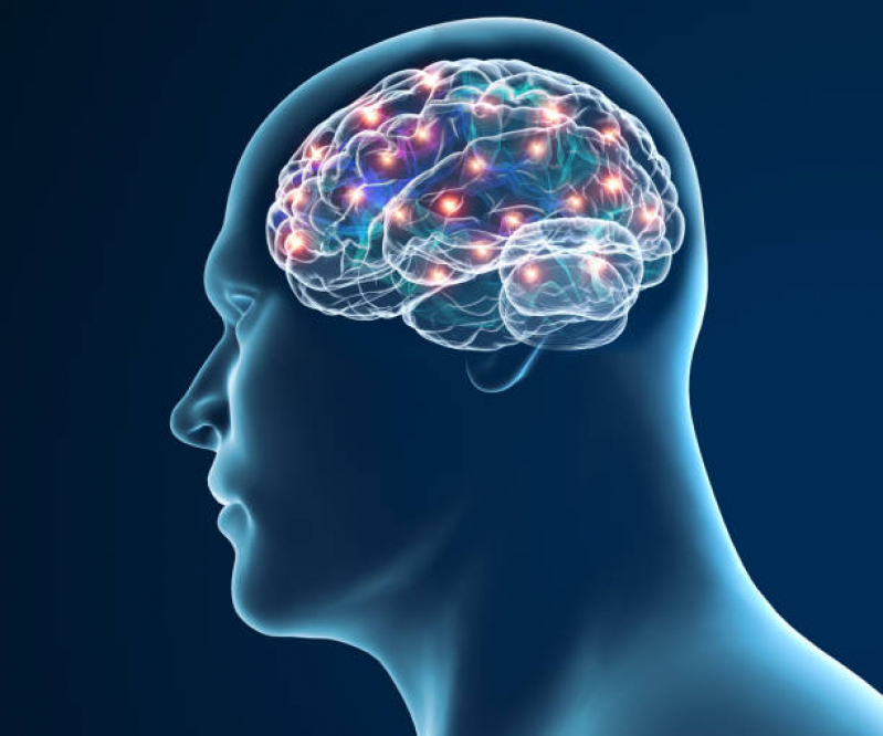 Neuromodulação Pós Avc Três Figueiras - Neuromodulação Cerebral