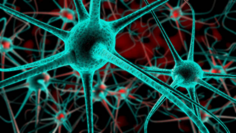 Onde Agendar Neromodulação para Parkinson Ipanema - Neuromodulação Cerebral
