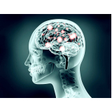 Neuromodulação Cerebral